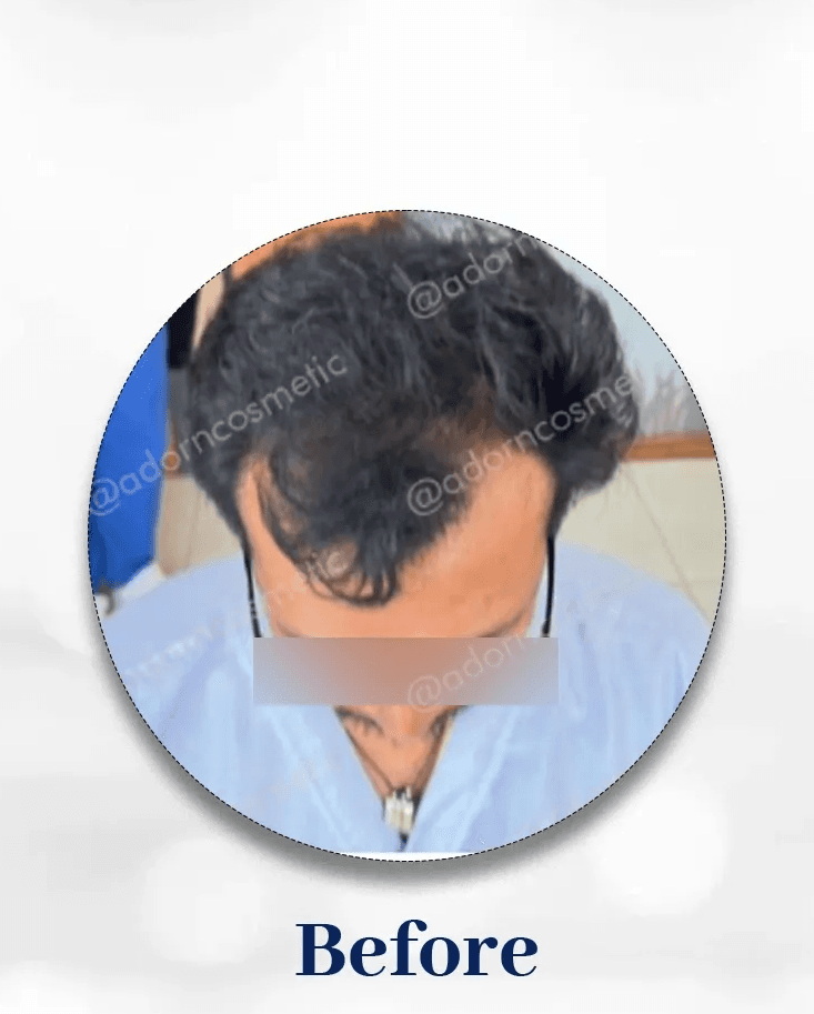 Image one