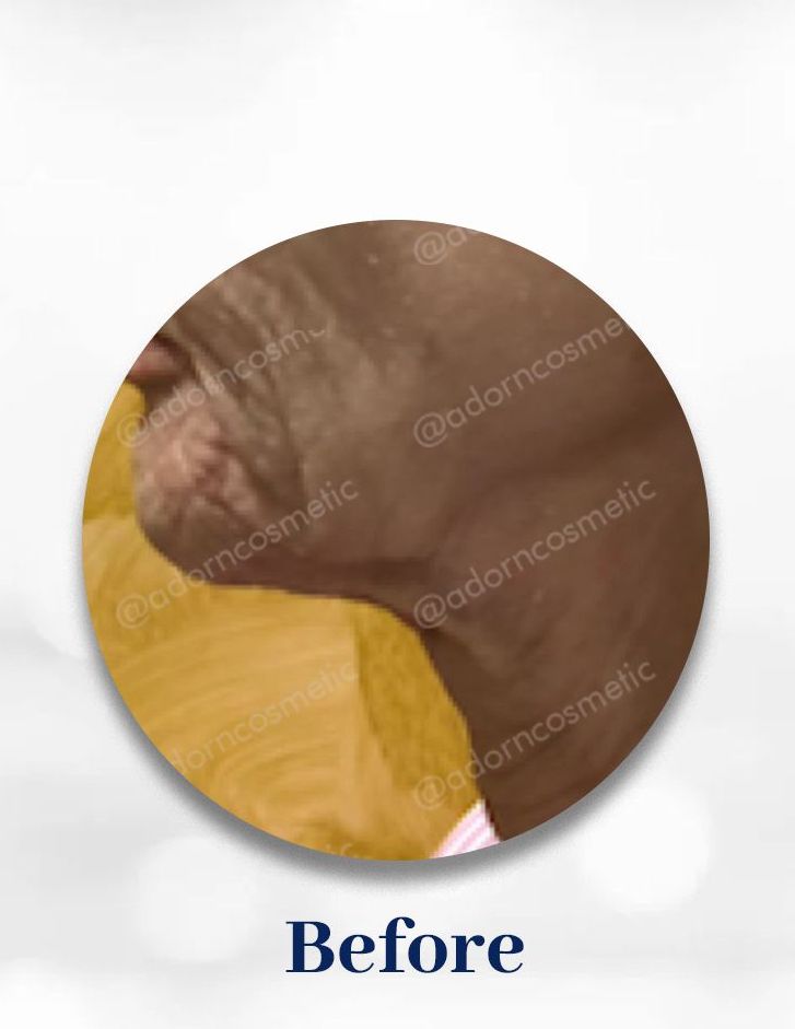 Image one