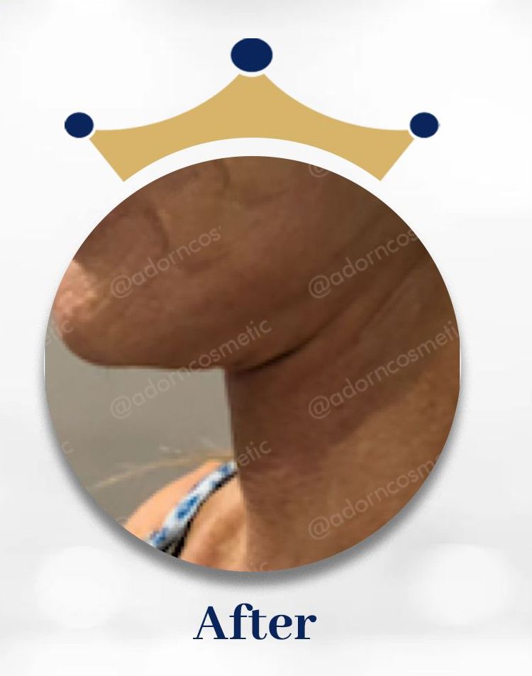 Image two