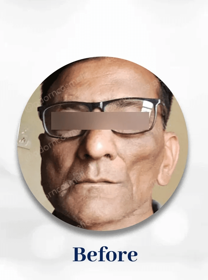 Image one
